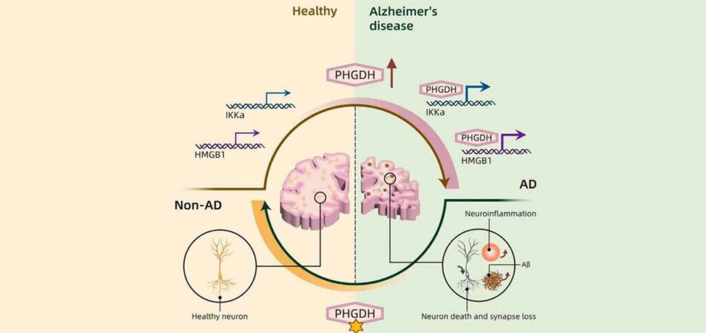 IA revela causa oculta do Alzheimer; veja